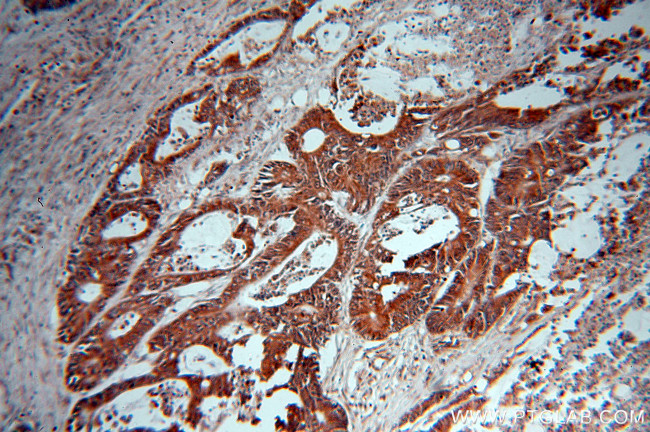 NOB1 Antibody in Immunohistochemistry (Paraffin) (IHC (P))