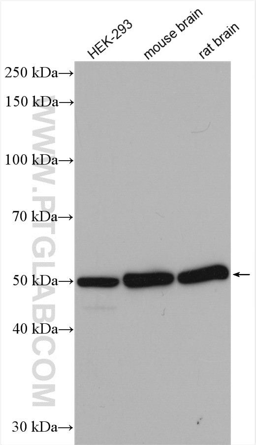 beta Tubulin Antibody in Western Blot (WB)