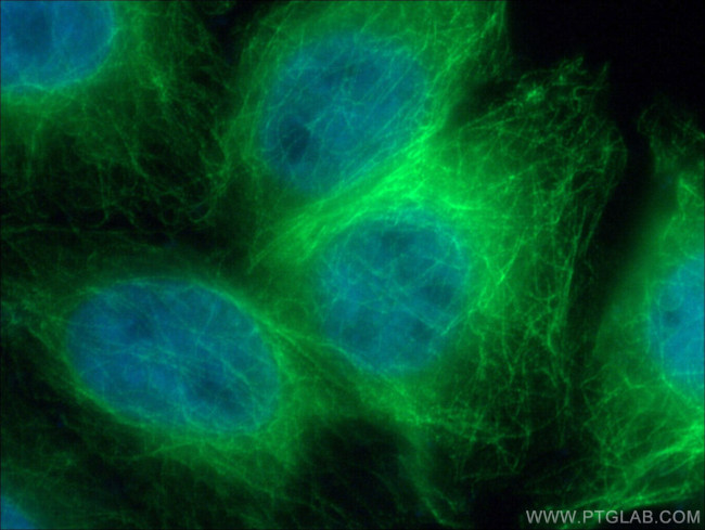 beta Tubulin Antibody in Immunocytochemistry (ICC/IF)