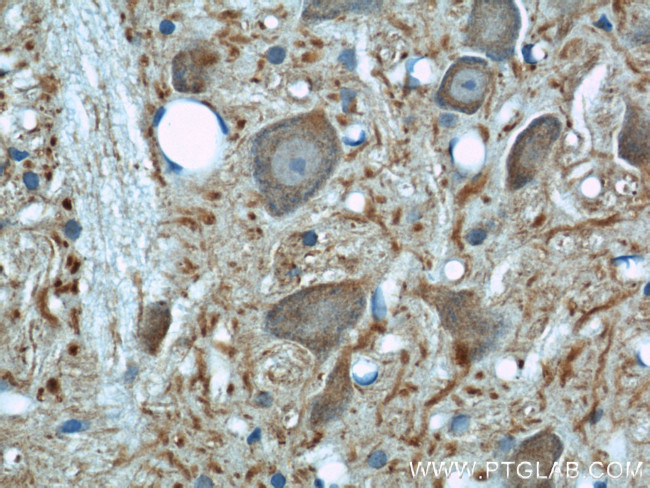 beta Tubulin Antibody in Immunohistochemistry (Paraffin) (IHC (P))