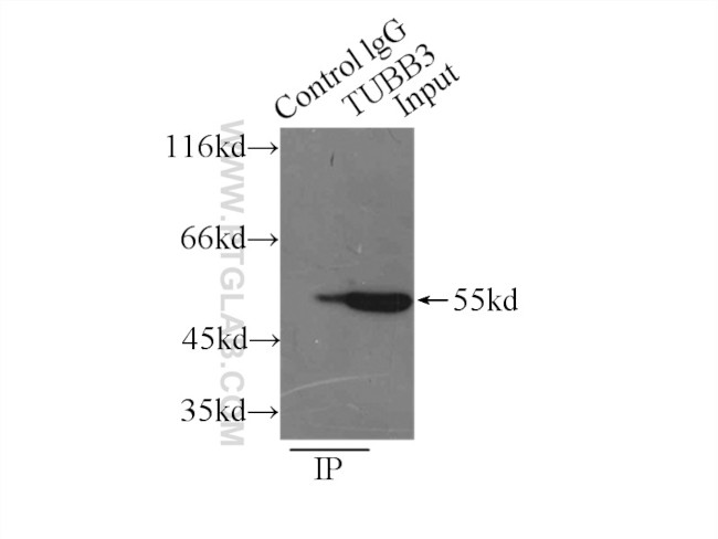 beta Tubulin Antibody in Immunoprecipitation (IP)