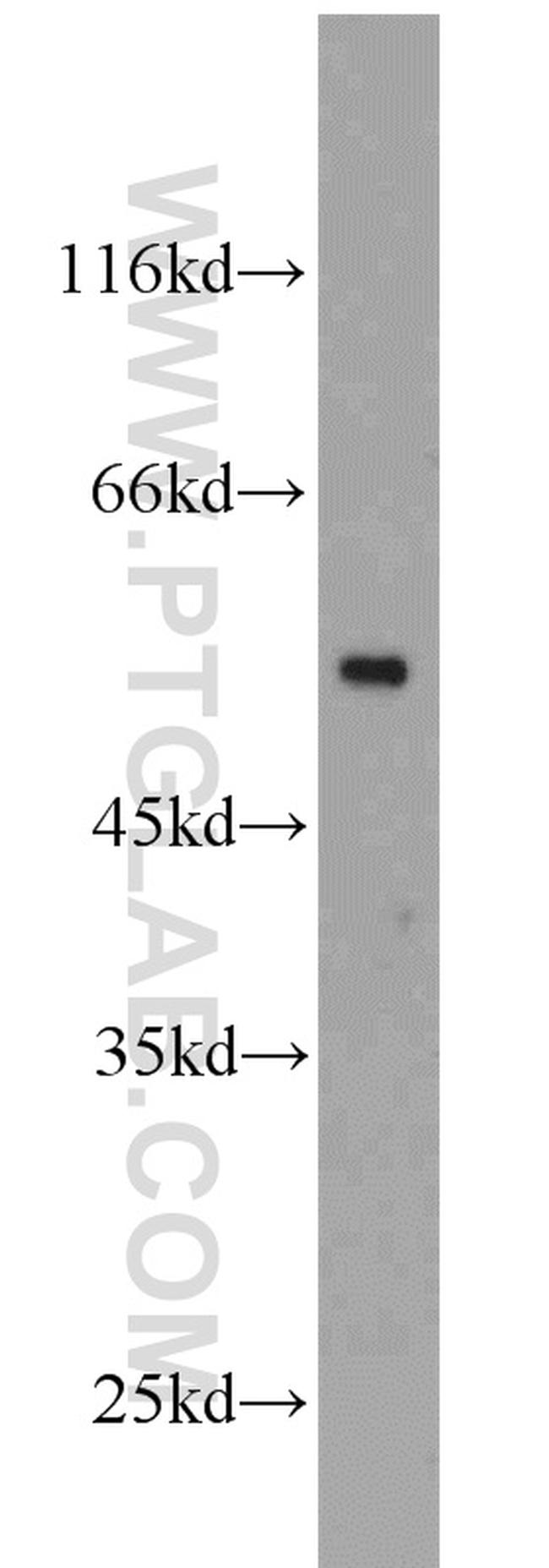 beta Tubulin Antibody in Western Blot (WB)