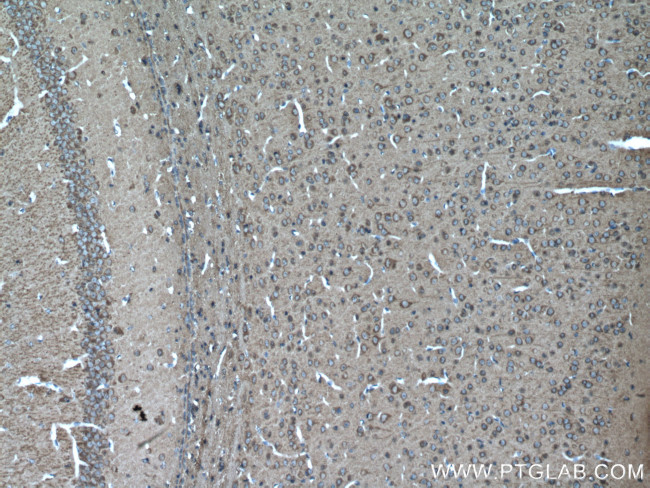 beta Tubulin Antibody in Immunohistochemistry (Paraffin) (IHC (P))