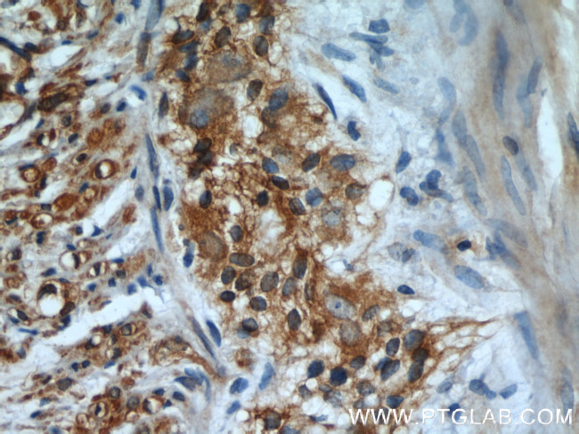 beta Tubulin Antibody in Immunohistochemistry (Paraffin) (IHC (P))