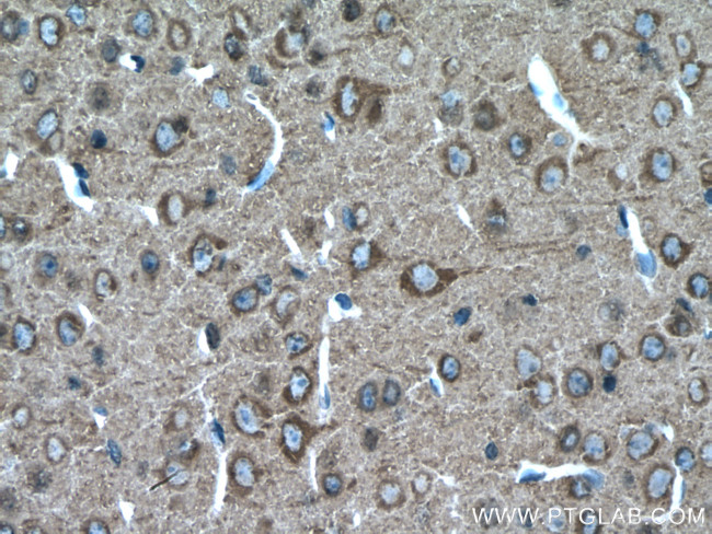 beta Tubulin Antibody in Immunohistochemistry (Paraffin) (IHC (P))