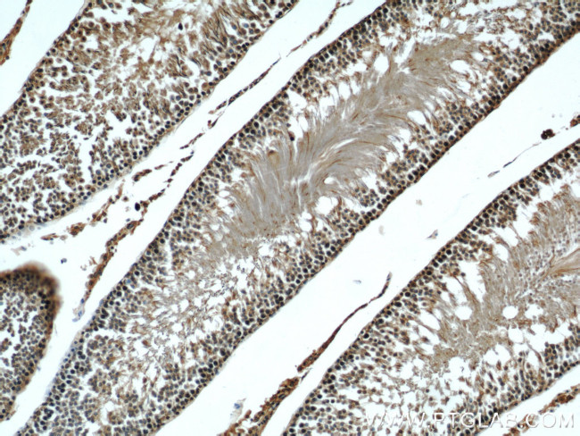 beta Tubulin Antibody in Immunohistochemistry (Paraffin) (IHC (P))