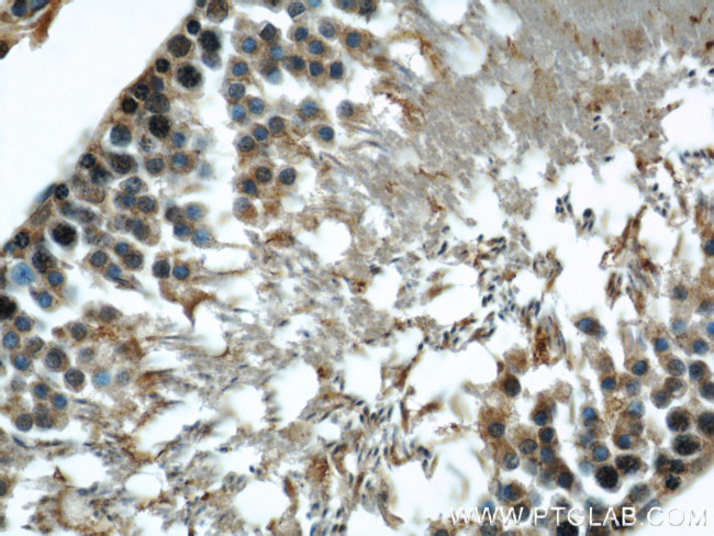 beta Tubulin Antibody in Immunohistochemistry (Paraffin) (IHC (P))