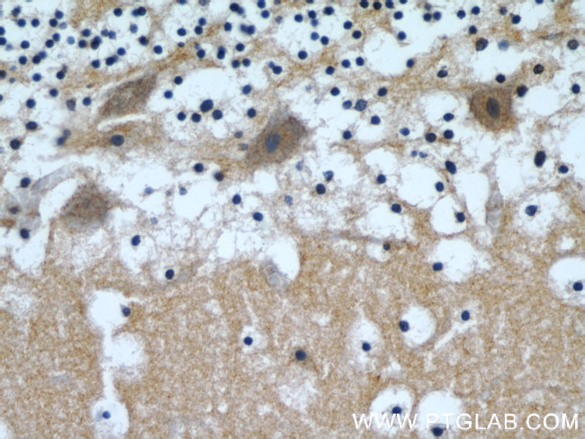 beta Tubulin Antibody in Immunohistochemistry (Paraffin) (IHC (P))