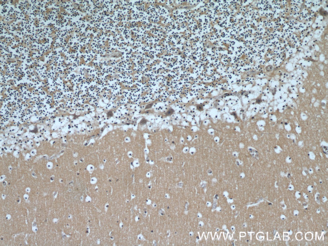 beta Tubulin Antibody in Immunohistochemistry (Paraffin) (IHC (P))