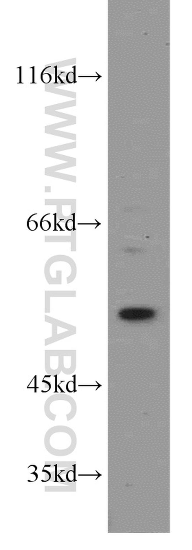 beta Tubulin Antibody in Western Blot (WB)