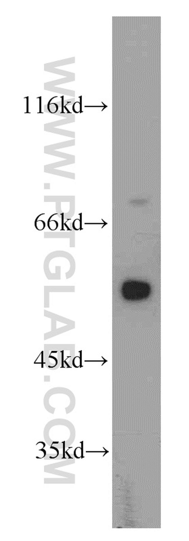 beta Tubulin Antibody in Western Blot (WB)