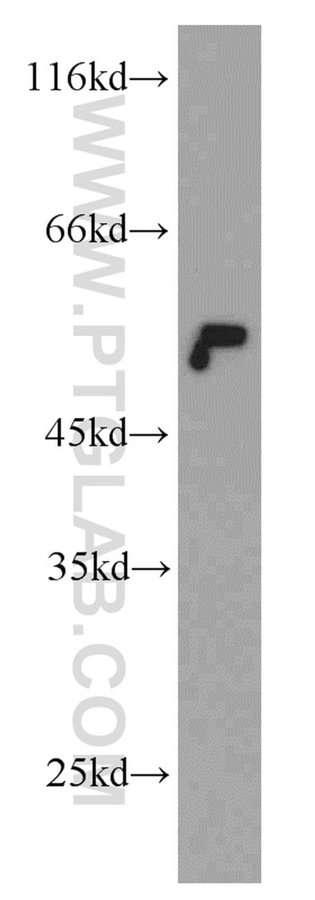 beta Tubulin Antibody in Western Blot (WB)