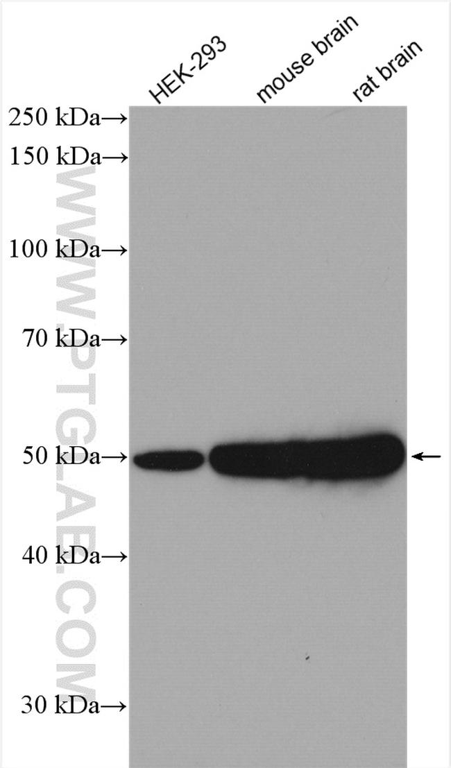 beta Tubulin Antibody in Western Blot (WB)