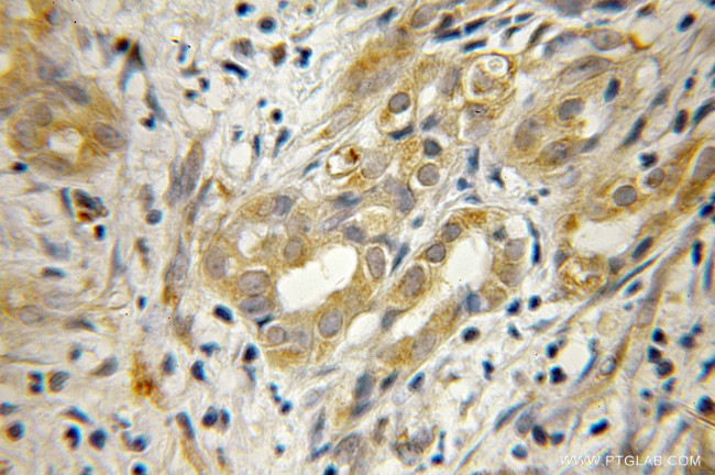 EEF1B2 Antibody in Immunohistochemistry (Paraffin) (IHC (P))