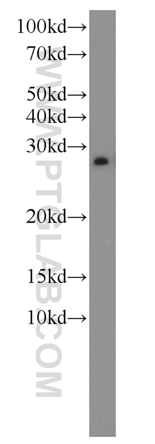 EEF1B2 Antibody in Western Blot (WB)