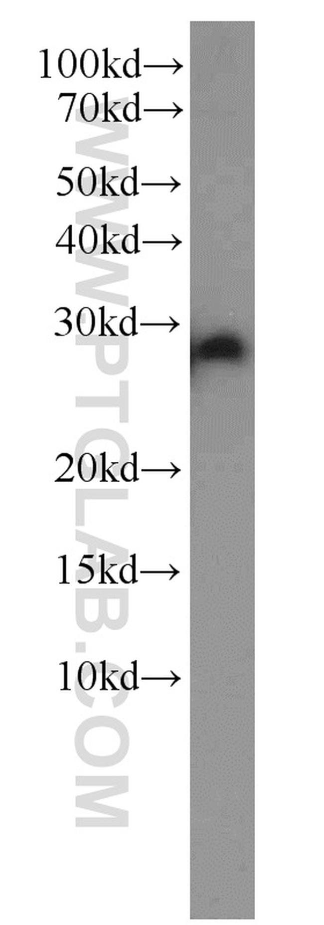 EEF1B2 Antibody in Western Blot (WB)