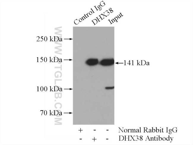 DHX38 Antibody in Immunoprecipitation (IP)