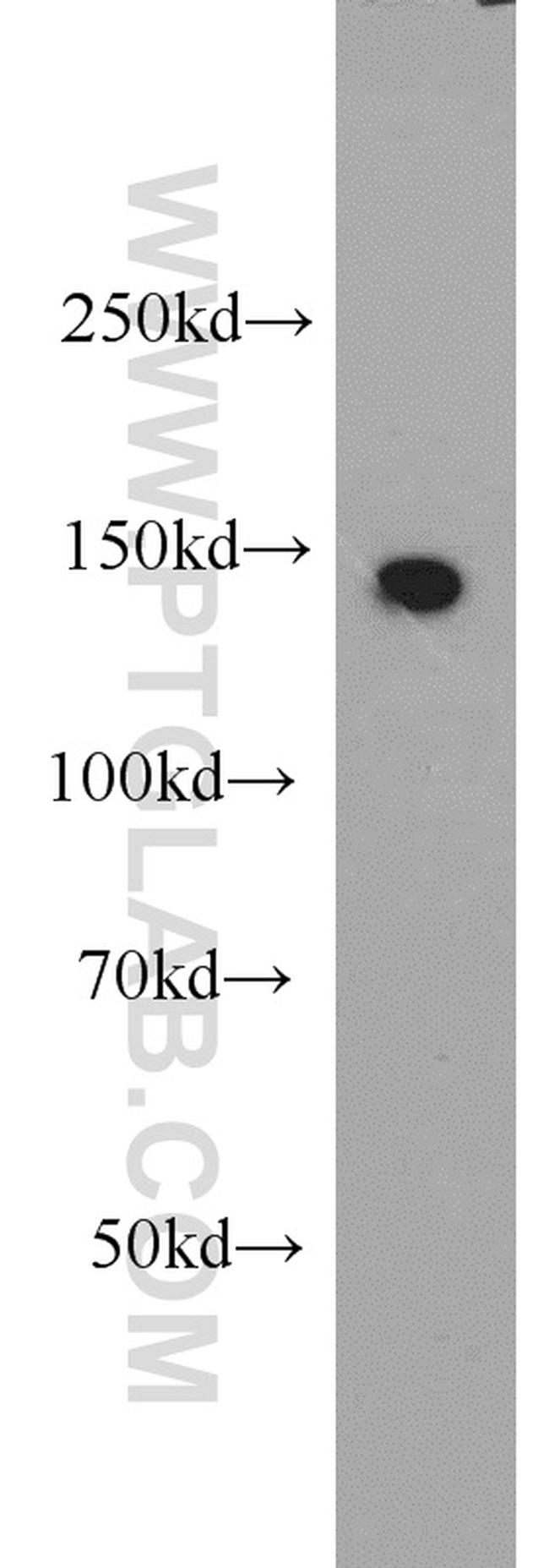 DHX38 Antibody in Western Blot (WB)