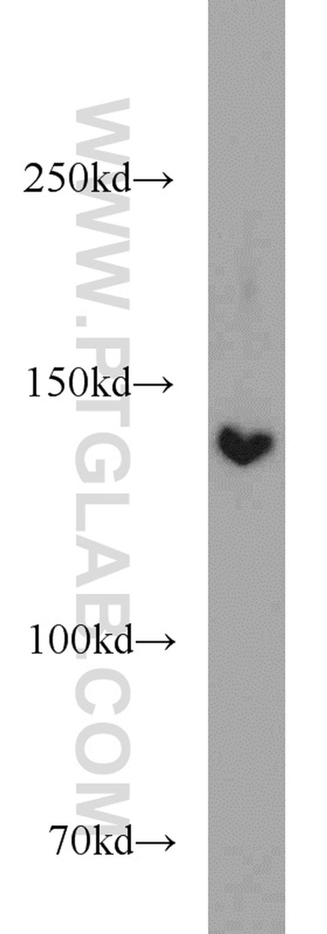 DHX38 Antibody in Western Blot (WB)