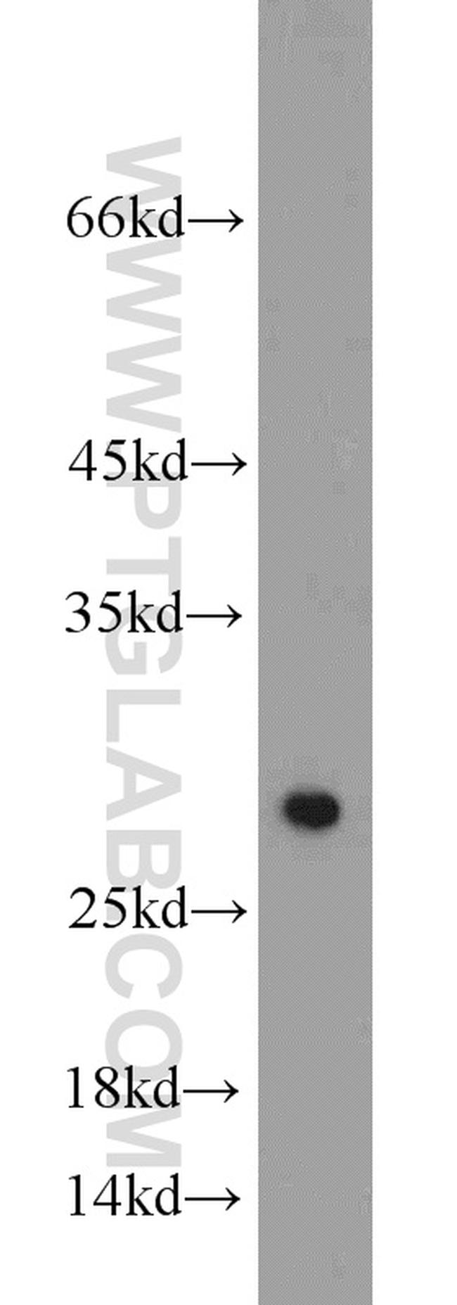 SIRT3 Antibody in Western Blot (WB)