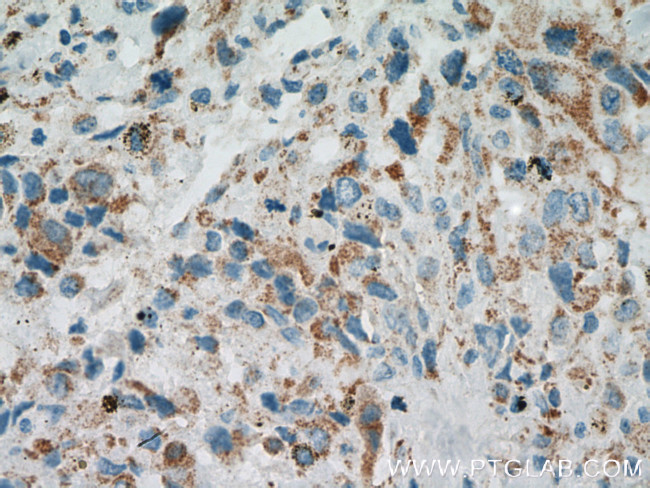 PITRM1 Antibody in Immunohistochemistry (Paraffin) (IHC (P))