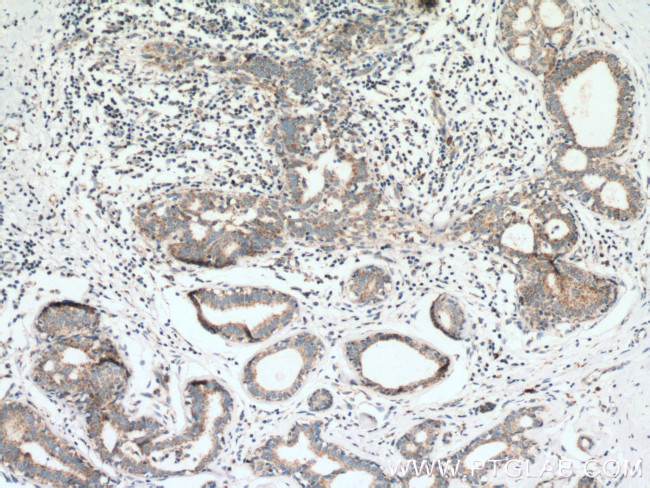 PITRM1 Antibody in Immunohistochemistry (Paraffin) (IHC (P))