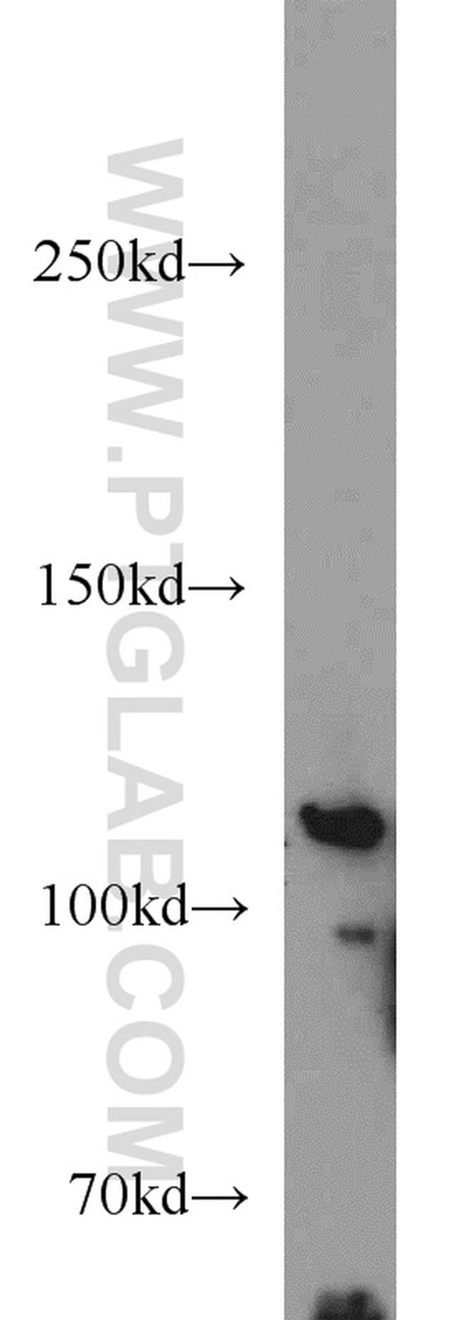 PITRM1 Antibody in Western Blot (WB)