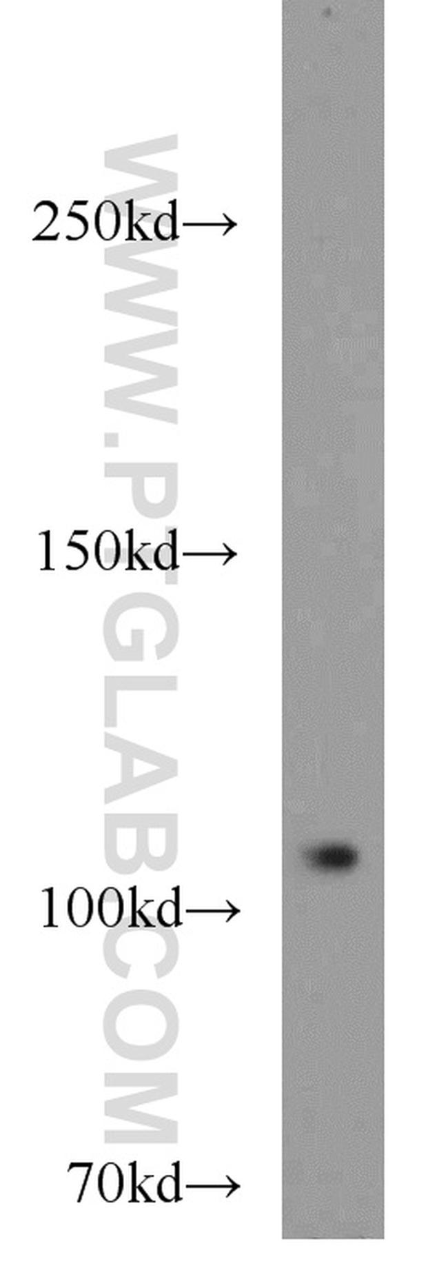 PITRM1 Antibody in Western Blot (WB)