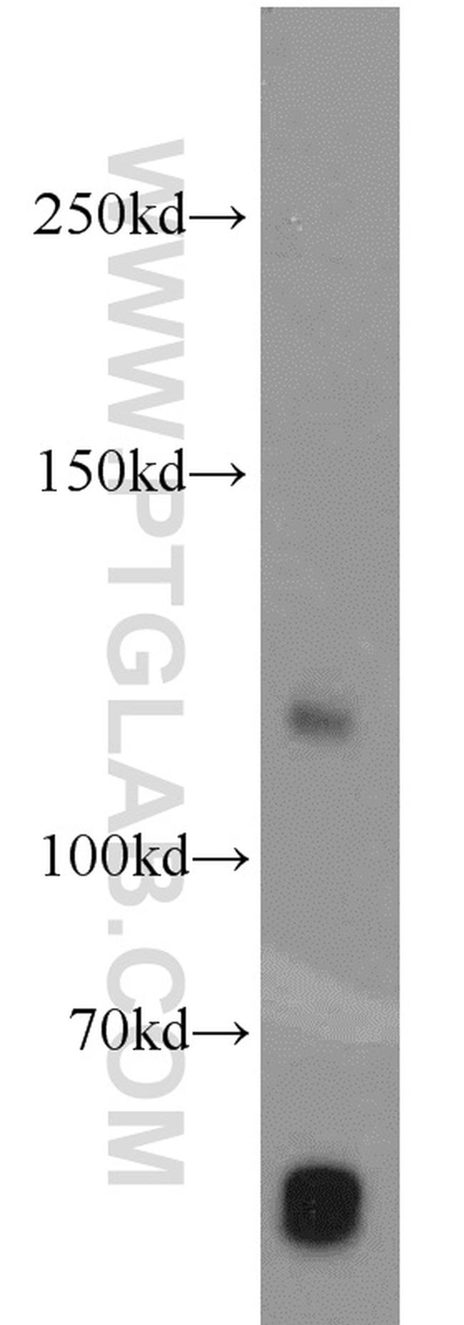 PITRM1 Antibody in Western Blot (WB)