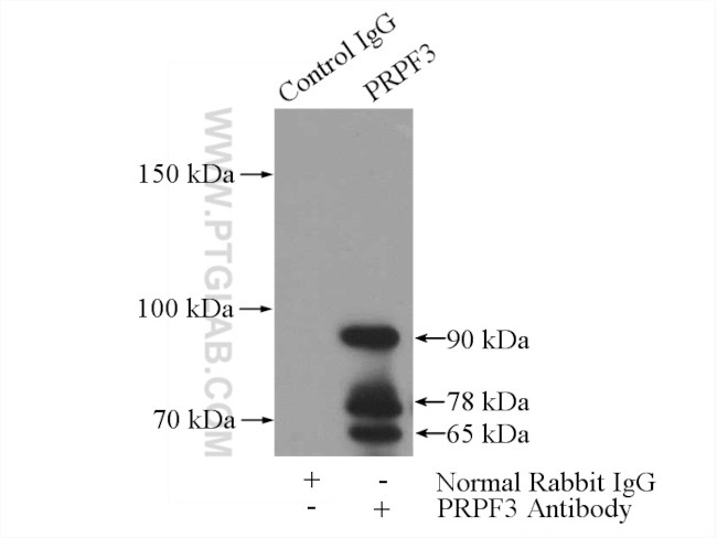 PRPF3 Antibody in Immunoprecipitation (IP)