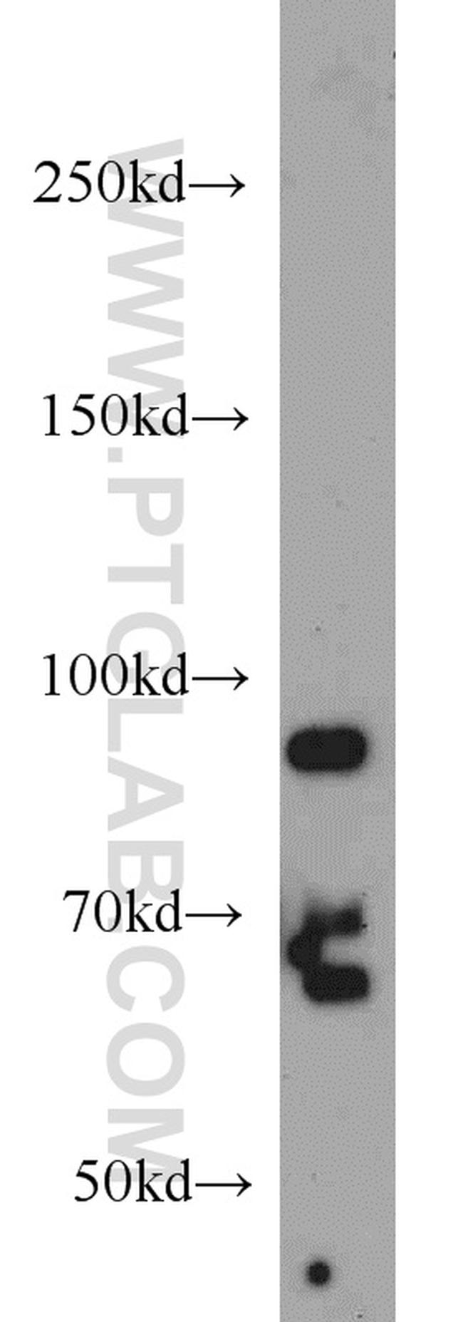 PRPF3 Antibody in Western Blot (WB)