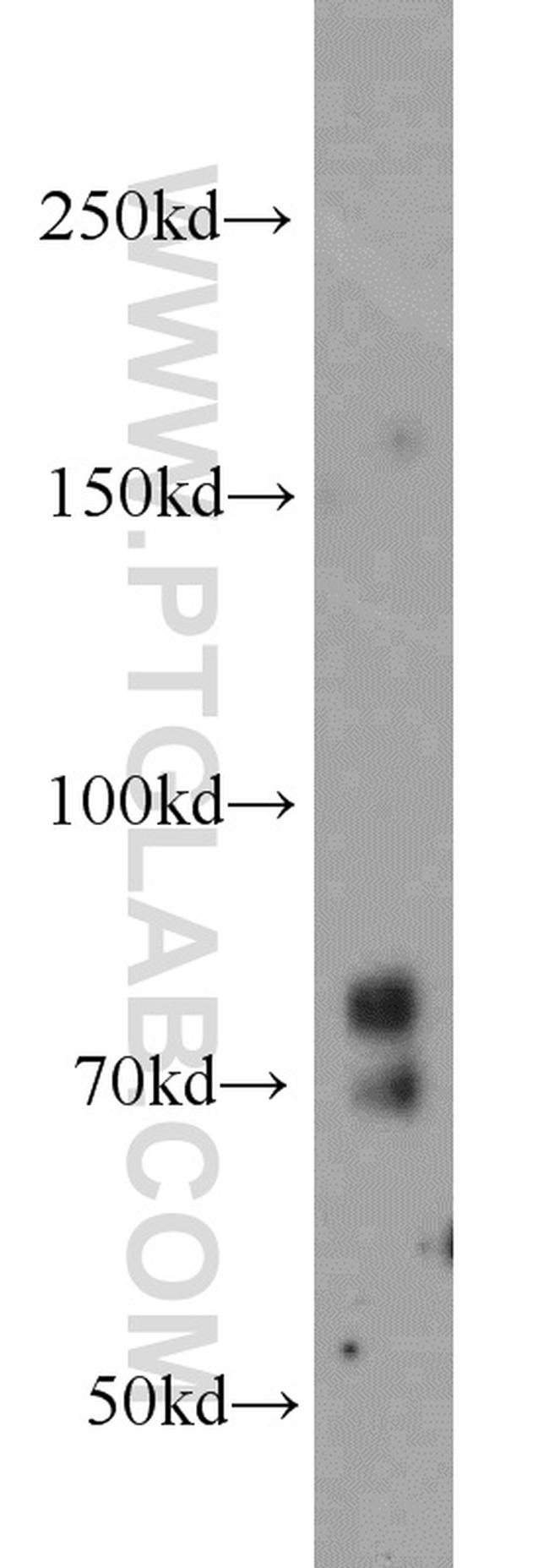 PRPF3 Antibody in Western Blot (WB)