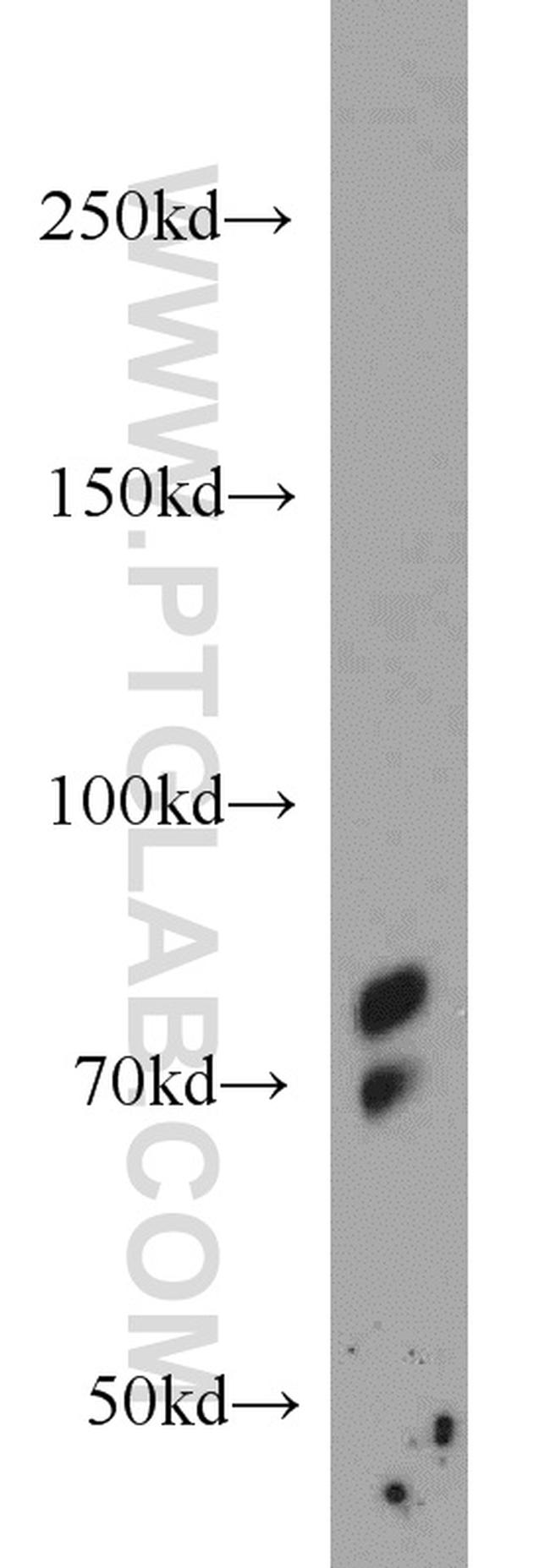 PRPF3 Antibody in Western Blot (WB)