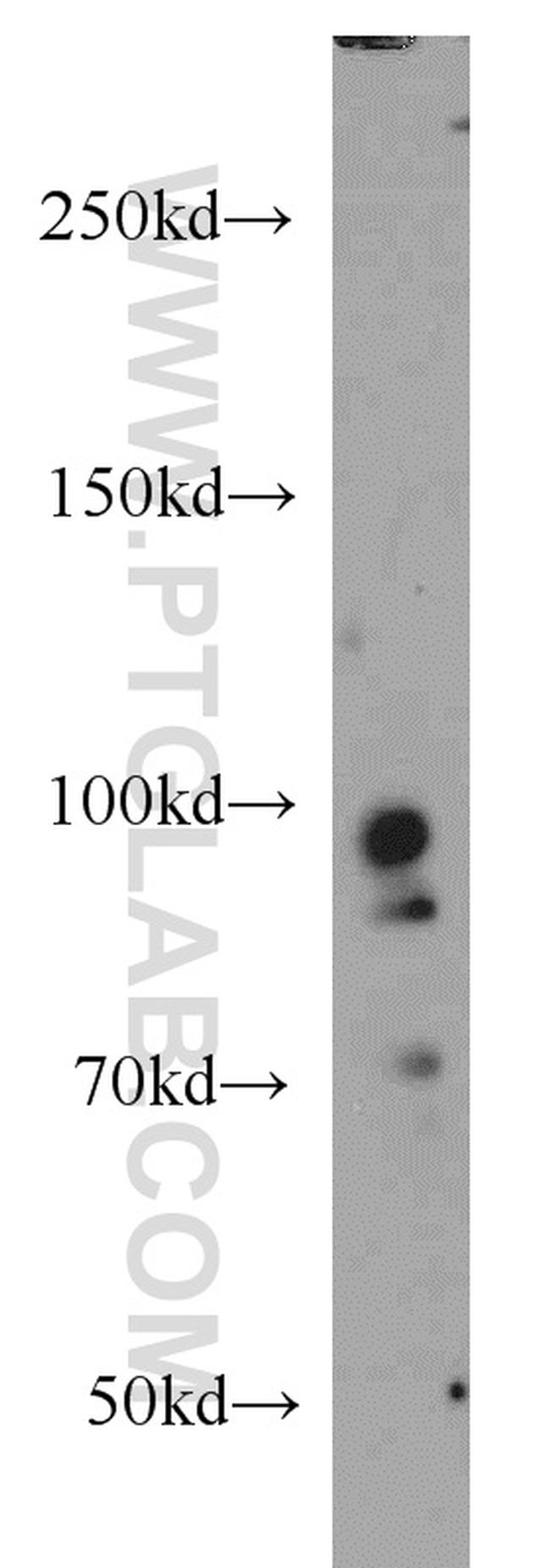 PRPF3 Antibody in Western Blot (WB)