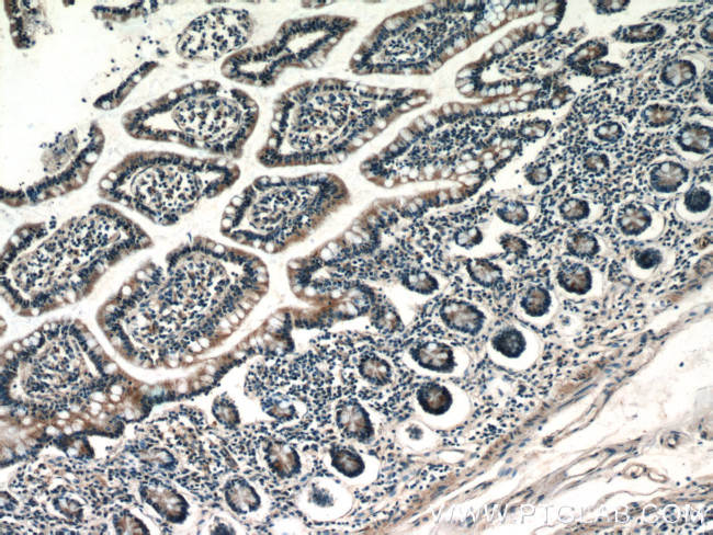 CX3CL1 Antibody in Immunohistochemistry (Paraffin) (IHC (P))