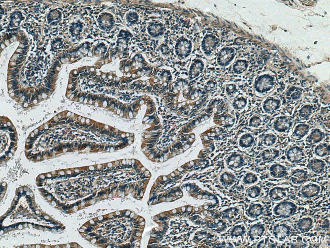 CX3CL1 Antibody in Immunohistochemistry (Paraffin) (IHC (P))