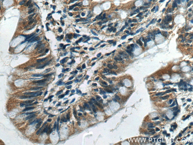 CX3CL1 Antibody in Immunohistochemistry (Paraffin) (IHC (P))