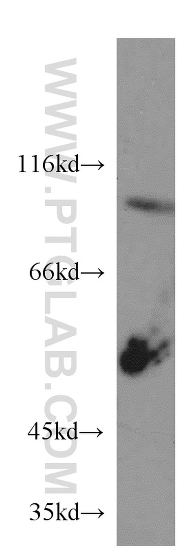 CX3CL1 Antibody in Western Blot (WB)