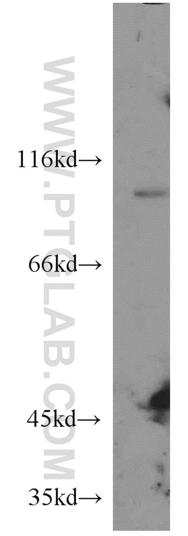 CX3CL1 Antibody in Western Blot (WB)