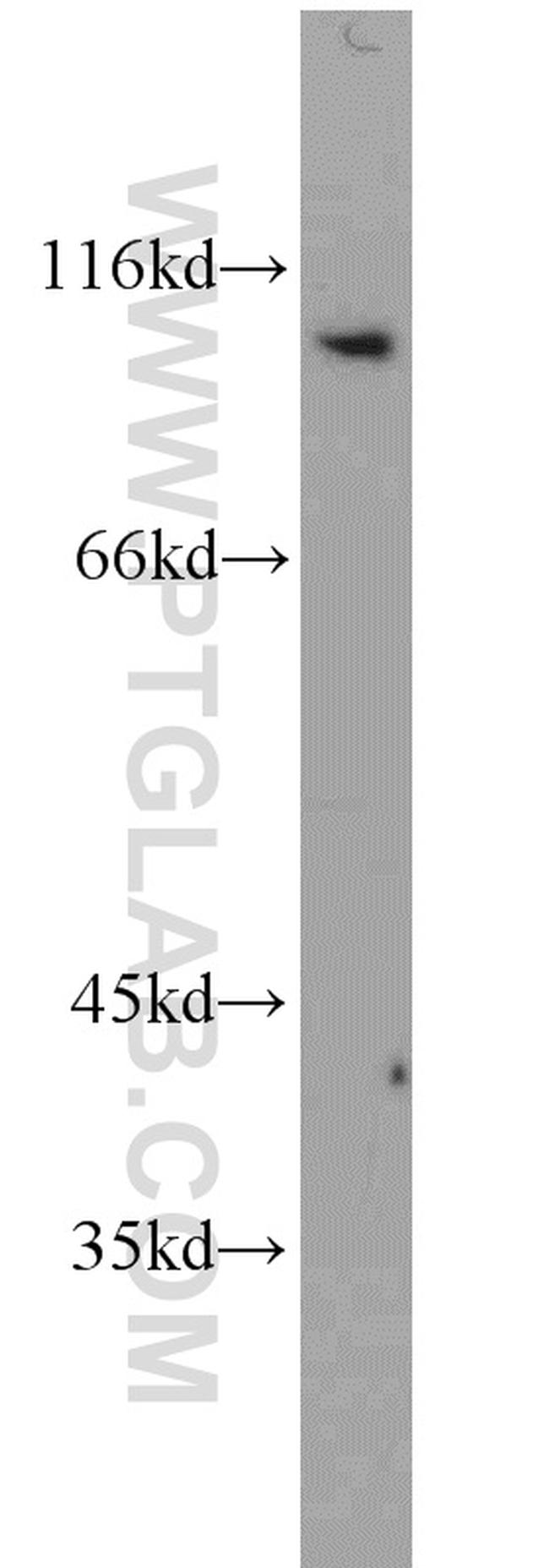 CX3CL1 Antibody in Western Blot (WB)