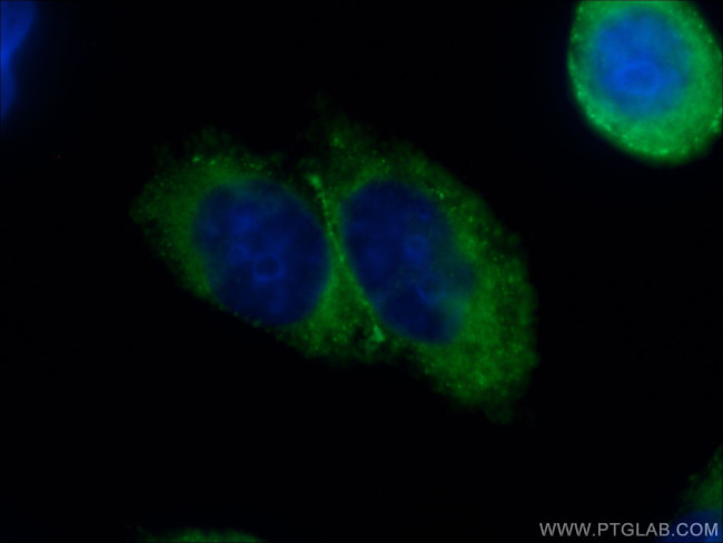 DAB2 Antibody in Immunocytochemistry (ICC/IF)