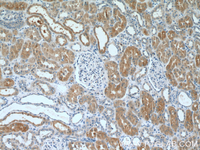 DAB2 Antibody in Immunohistochemistry (Paraffin) (IHC (P))