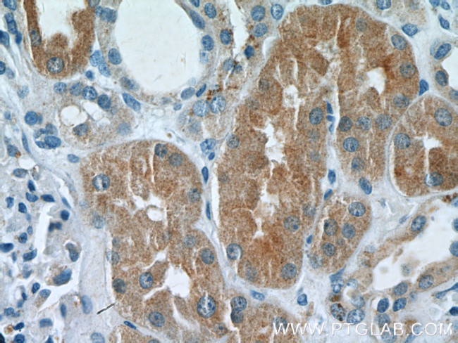 DAB2 Antibody in Immunohistochemistry (Paraffin) (IHC (P))