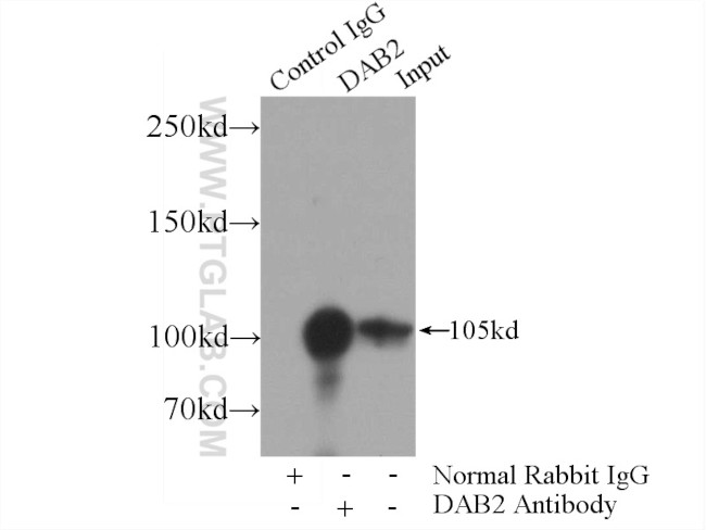 DAB2 Antibody in Immunoprecipitation (IP)