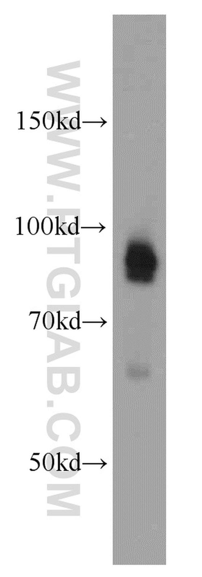 DAB2 Antibody in Western Blot (WB)