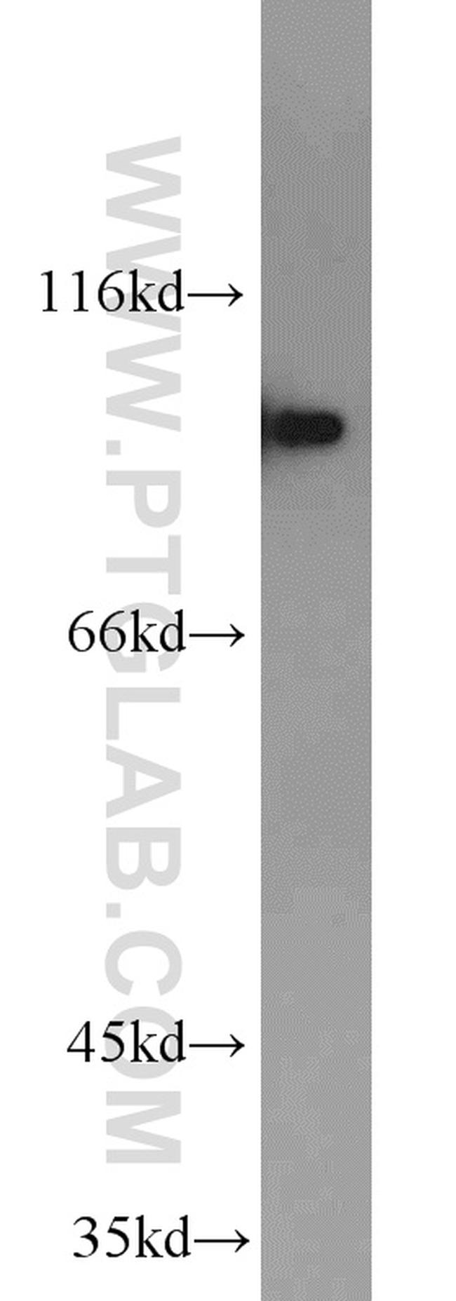 DAB2 Antibody in Western Blot (WB)