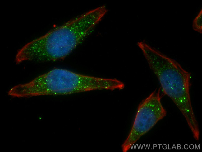 SNX6 Antibody in Immunocytochemistry (ICC/IF)