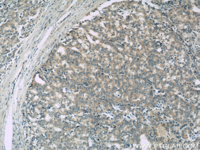 SNX6 Antibody in Immunohistochemistry (Paraffin) (IHC (P))