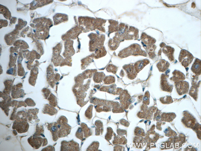 SNX6 Antibody in Immunohistochemistry (Paraffin) (IHC (P))