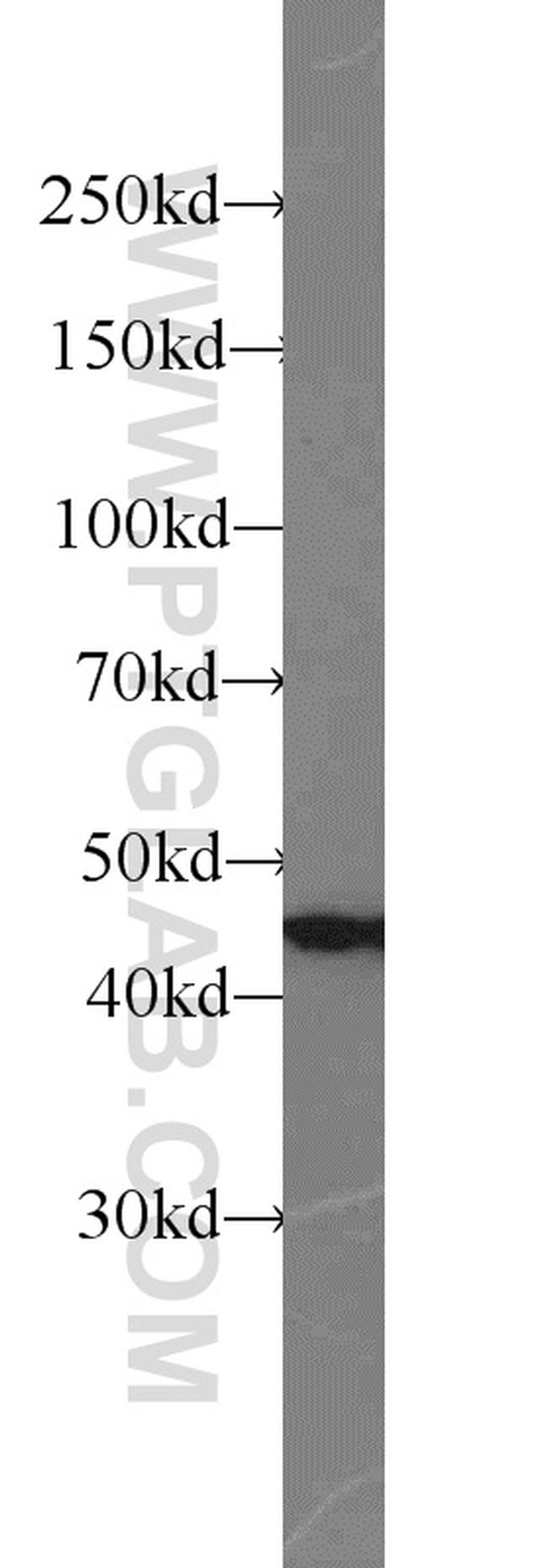 SNX6 Antibody in Western Blot (WB)